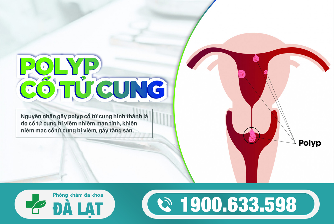 Hình ảnh minh họa